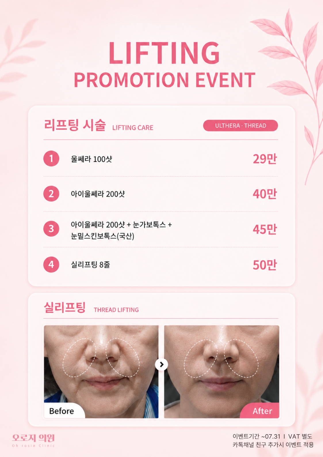 💖리프팅 이벤트💖